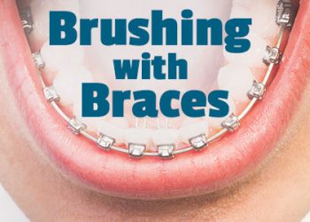 Dickinson dentist, Dr. Agee Kunjumon at Touchstone Dentistry, informs patients about the best tools and tricks to use when performing oral hygiene routines with braces.