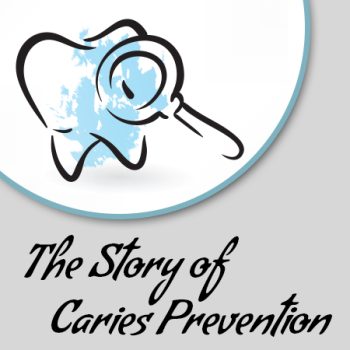 Dickinson dentist, Dr. Agee Kunjumon at Touchstone Dentistry, explains the link between tooth decay, dental caries, and cavities.