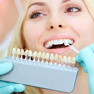 A dental professional holds up a tooth shade guide next to a woman's teeth for a cosmetic dentistry consultation.