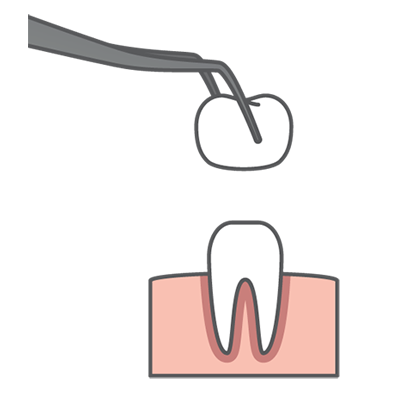 Dental Crown Graphic
