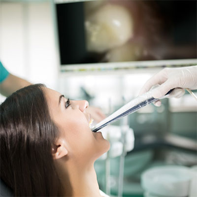 Intraoral Camera