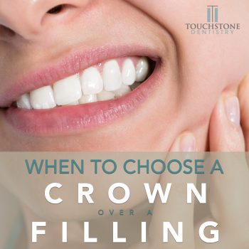 Learn when to choose a dental crown over a filling for your tooth restoration at Touchstone Dentistry in League City. Protect your smile with the right treatment.