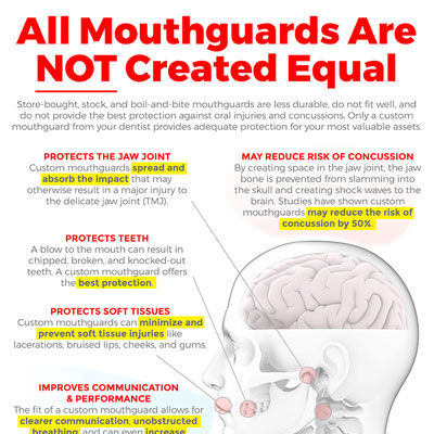 Mouthguards Infographics