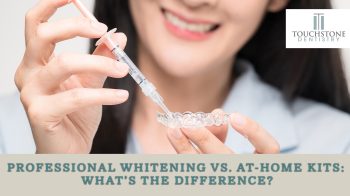 Considering teeth whitening in League City? Learn the difference between professional whitening at Touchstone Dentistry and store-bought kits. Find the right solution for your smile.