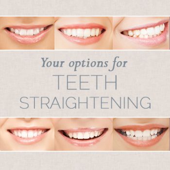 Dickinson dentist, Dr. Agee Kunjumon at Touchstone Dentistry, shares all you need to know about choosing the right teeth straightening option for you.